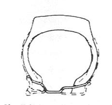 ROUES DE VOITURE (construction métallique, pneus, types de pneus) 9 ROUES DE VOITURE (construction métallique, pneus, types de pneus) - 7